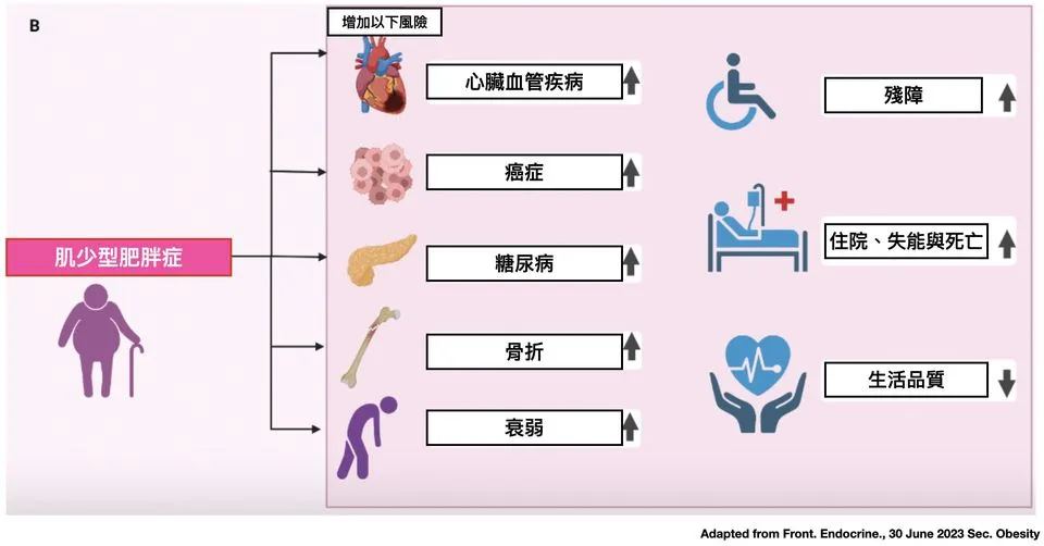 什麼是肌少型肥胖症？我如何得知自己是否有肌少型肥胖症？